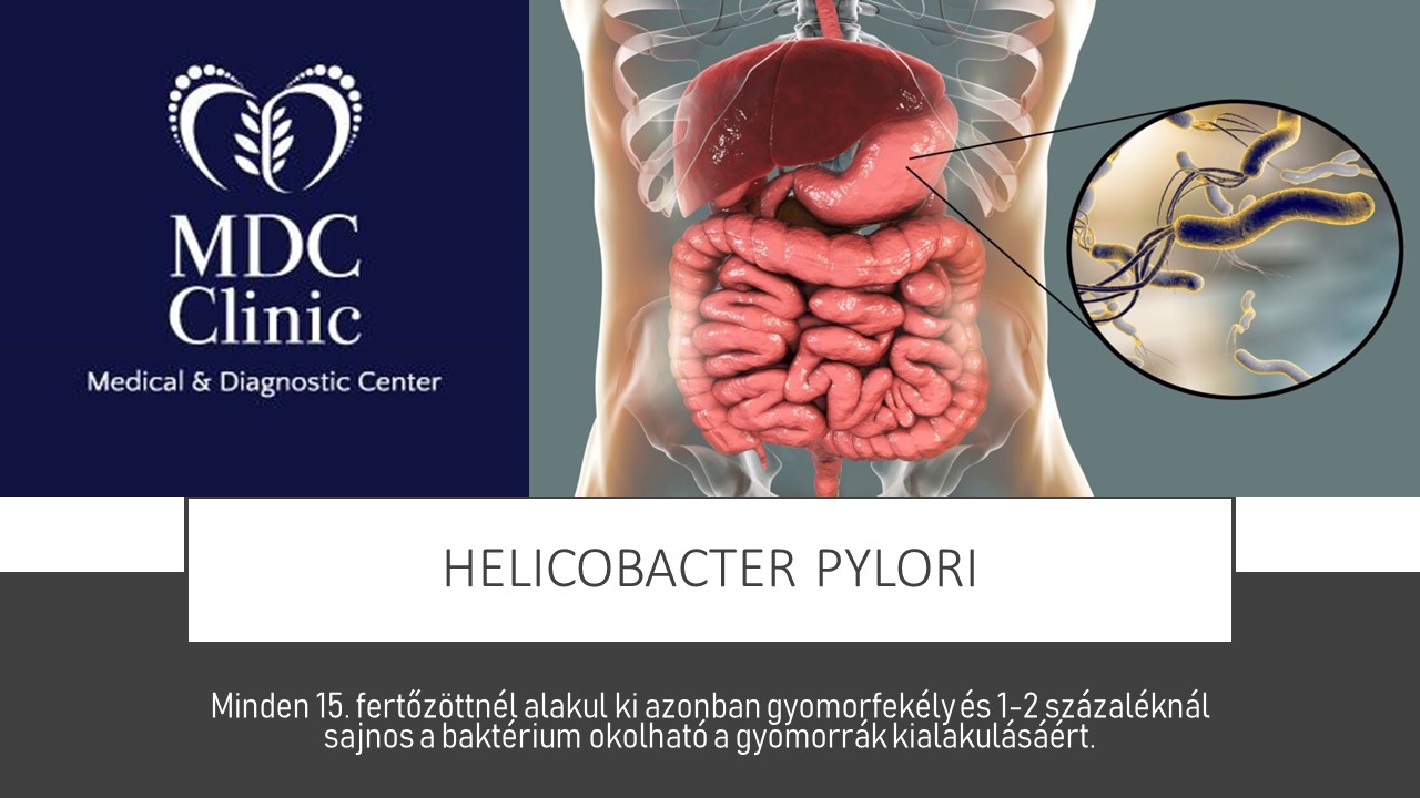 gyomorrák helicobacter pylori